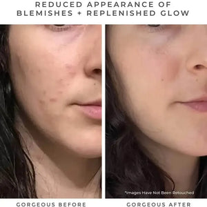 OASIS Deep Pore Gel Cleanser: Chlorophyll + Botanical BHA