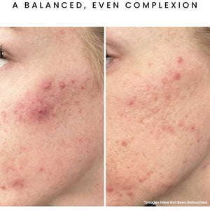 GLOW JUICE 10-Acid Refining Peel: Fruit AHA/BHA : 2 oz