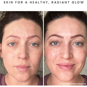CALYPSO Antioxidant Glow Facial Oil: Sea Vitamin C + CoQ10